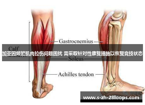 加亚因频繁肌肉拉伤问题困扰 需采取针对性康复措施以恢复竞技状态